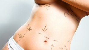 Breast augmentation and abdominal cosmetic surgeries