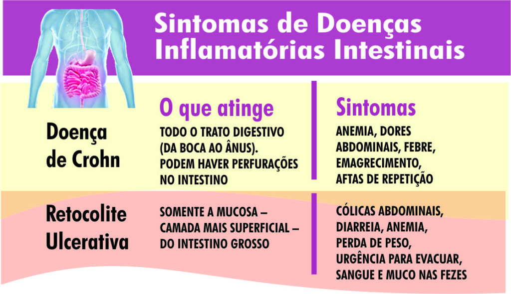 Doenças Inflamatórias Intestinais