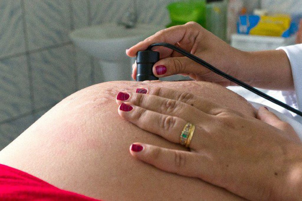 Saúde recomenda cálcio para todas as gestantes para prevenir eclâmpsia