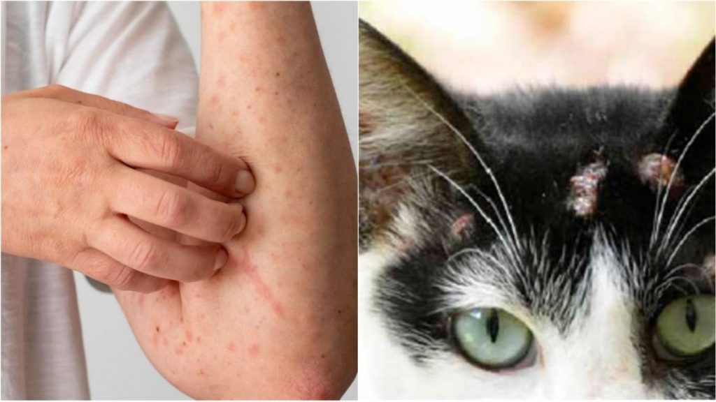 Santos capacita rede de saúde para identificar e tratar a Esporotricose