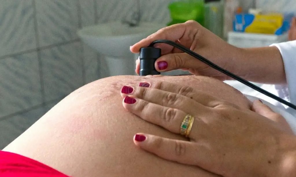 Exame pré-natal reduz chance de bebê nascer com anomalia