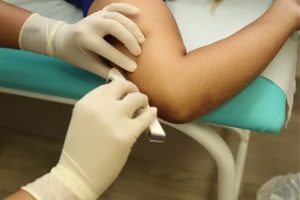 São Vicente abre inscrições para adolescentes aplicarem Implanon